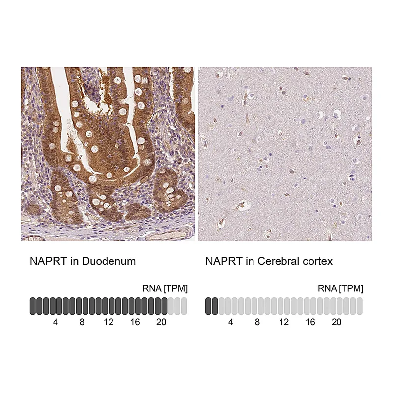 Atlas Antibodies Anti-NAPRT Antibody