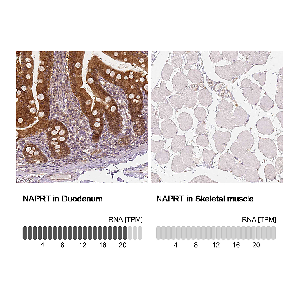 Atlas Antibodies Anti-NAPRT Antibody