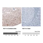 Atlas Antibodies Anti-NEFH Antibody
