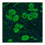 Atlas Antibodies Anti-NEFM Antibody