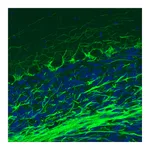 Atlas Antibodies Anti-NEFM Antibody