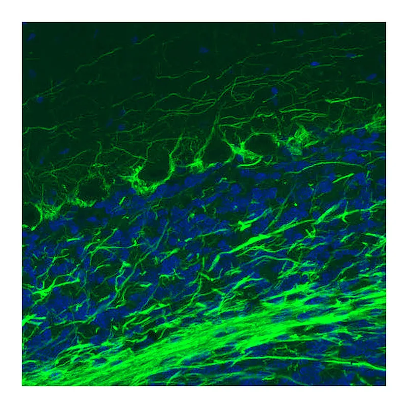 Atlas Antibodies Anti-NEFM Antibody
