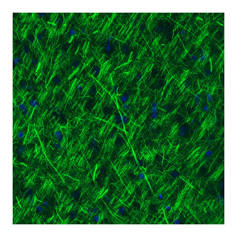 Atlas Antibodies Anti-NEFM Antibody