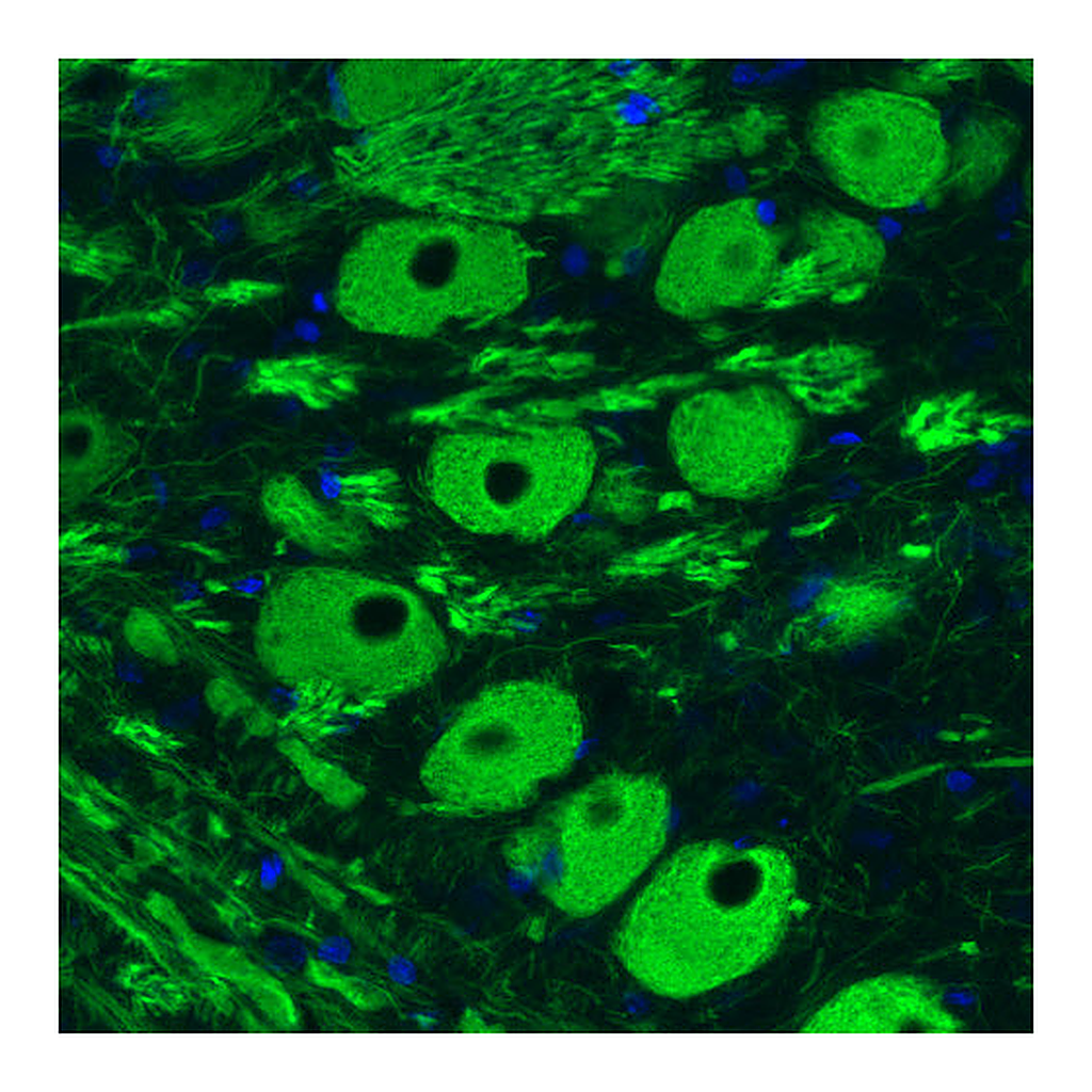 Atlas Antibodies Anti-NEFM Antibody