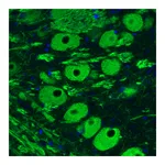 Atlas Antibodies Anti-NEFM Antibody