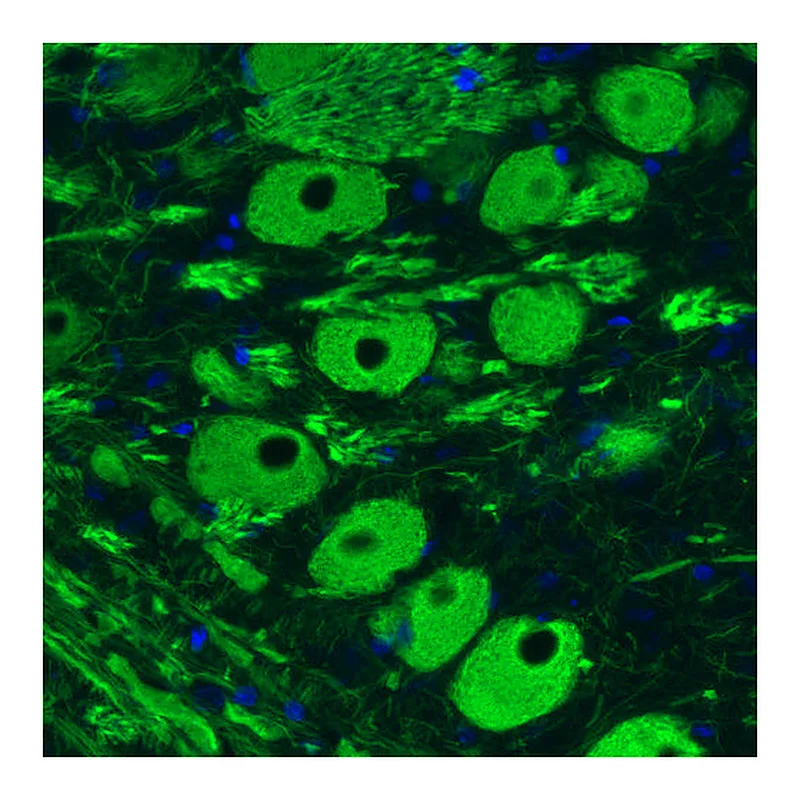 Atlas Antibodies Anti-NEFM Antibody