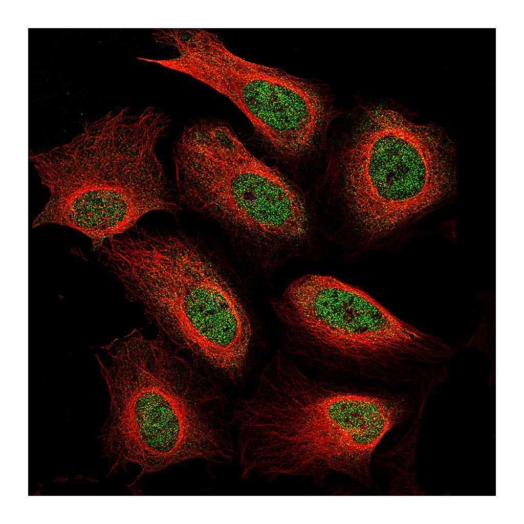 Atlas Antibodies Anti-NF1 Antibody