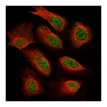 Atlas Antibodies Anti-NF1 Antibody