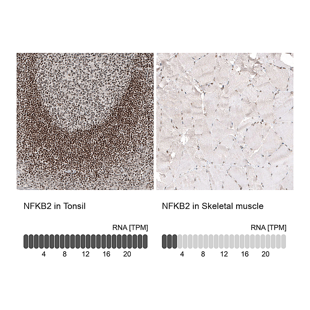 Atlas Antibodies Anti-NFKB2 Antibody