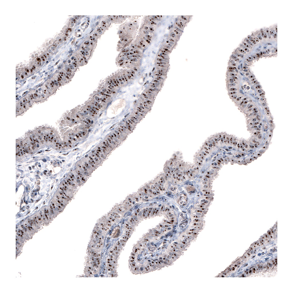 Atlas Antibodies Anti-NIFK Antibody