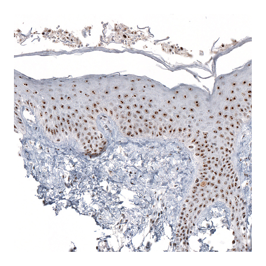 Atlas Antibodies Anti-NIFK Antibody