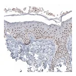 Atlas Antibodies Anti-NIFK Antibody