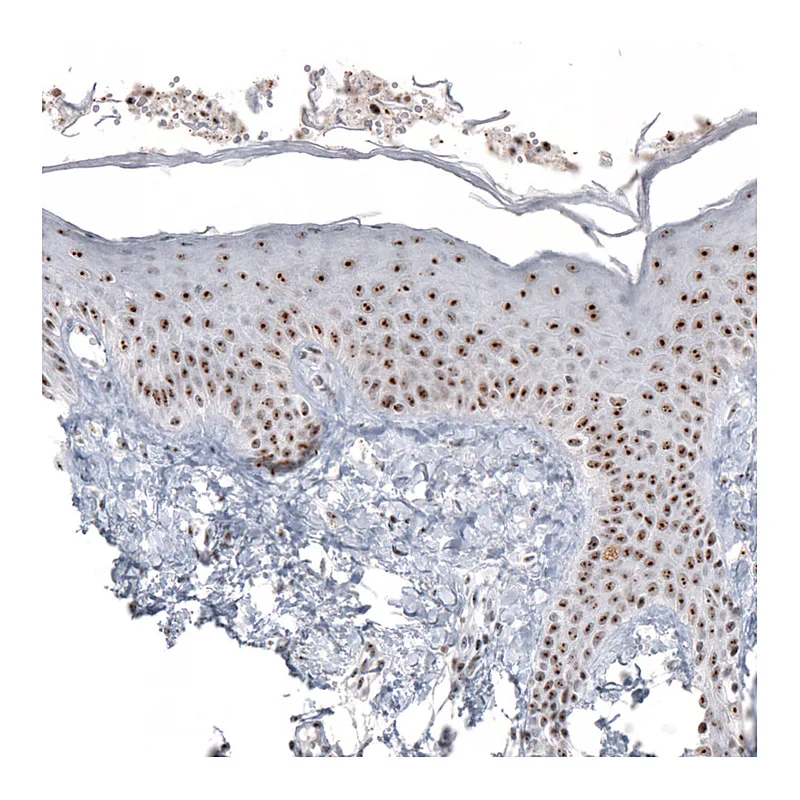 Atlas Antibodies Anti-NIFK Antibody