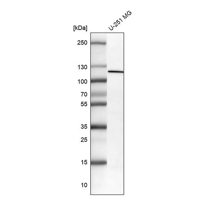 Atlas Antibodies Anti-NLRP3 Antibody