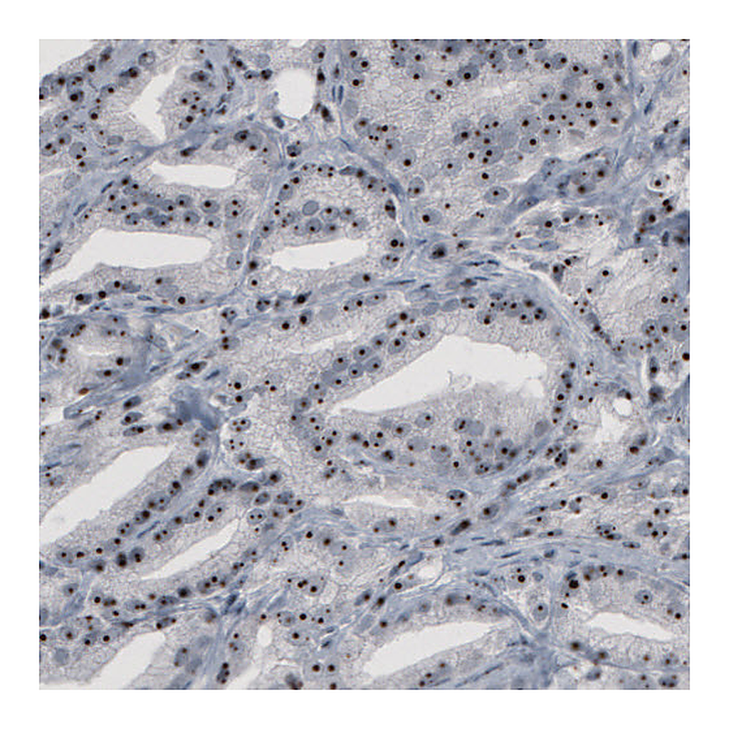 Atlas Antibodies Anti-NOP56 Antibody