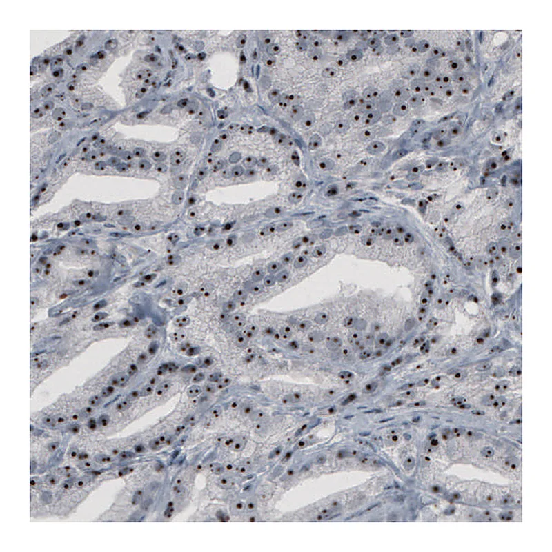 Atlas Antibodies Anti-NOP56 Antibody