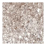 Atlas Antibodies Anti-NR5A1 Antibody