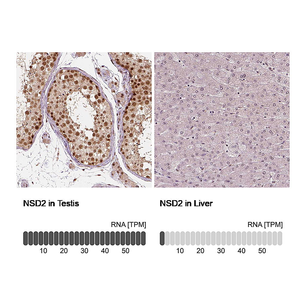Atlas Antibodies Anti-NSD2 Antibody