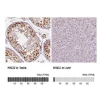 Atlas Antibodies Anti-NSD2 Antibody