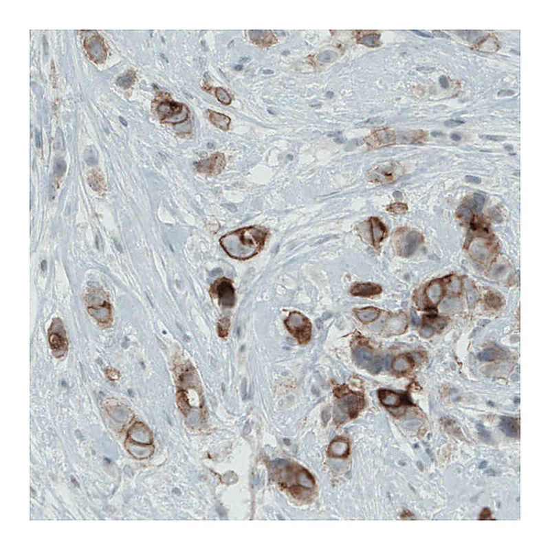 Atlas Antibodies Anti-OCLN Antibody