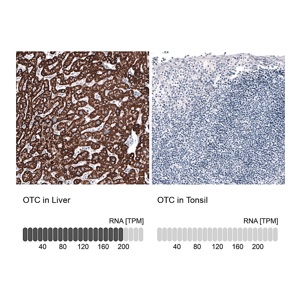 Atlas Antibodies Anti-OTC Antibody