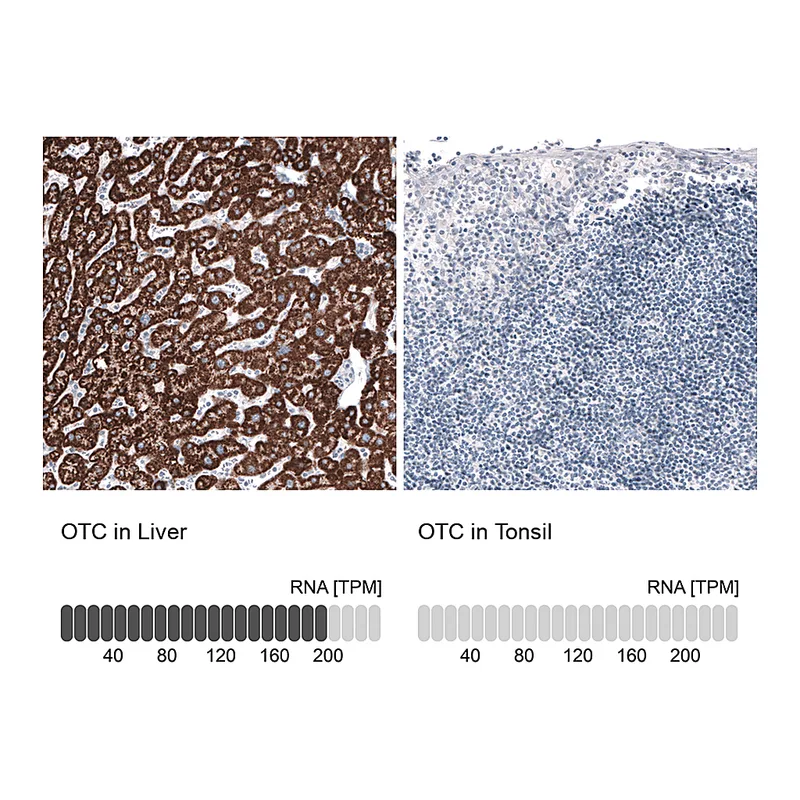 Atlas Antibodies Anti-OTC Antibody