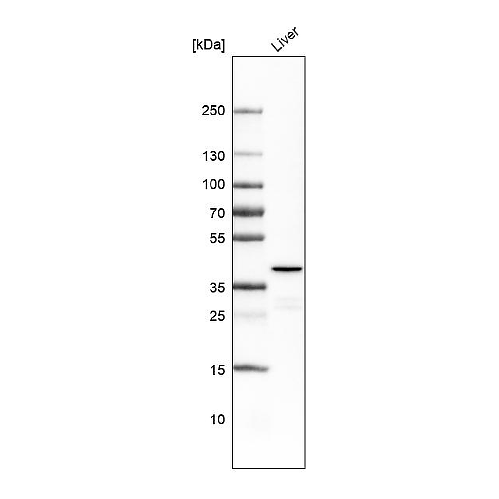 Atlas Antibodies Anti-OTC Antibody