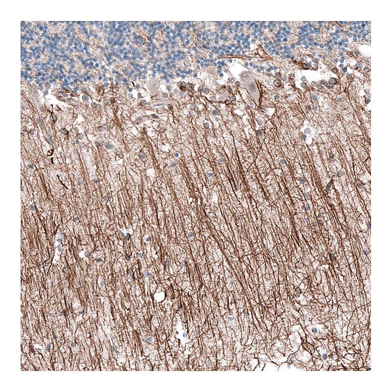 Atlas Antibodies Anti-P2RX7 Antibody