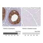 Atlas Antibodies Anti-P4HA2 Antibody