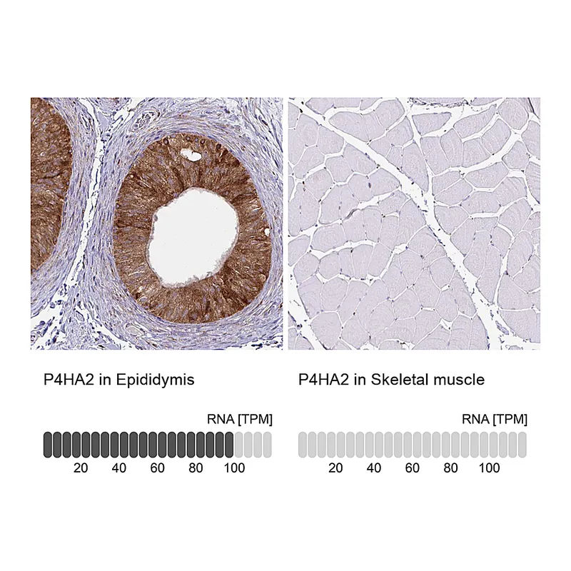 Atlas Antibodies Anti-P4HA2 Antibody