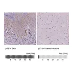 Atlas Antibodies Anti-p53 Antibody