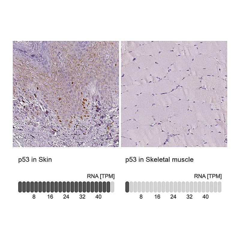 Atlas Antibodies Anti-p53 Antibody