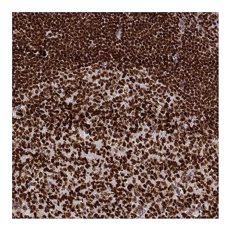 Atlas Antibodies Anti-PARP1 Antibody