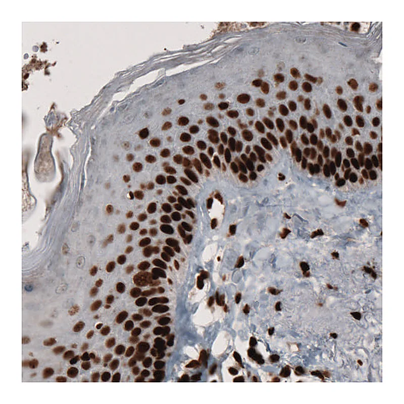 Atlas Antibodies Anti-PARP1 Antibody
