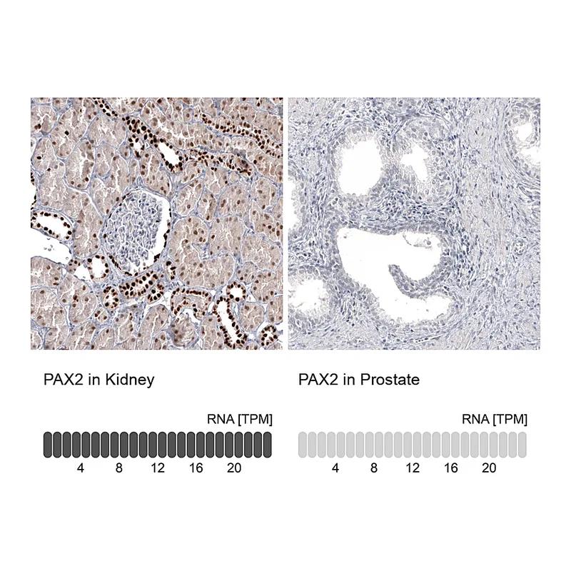 Atlas Antibodies Anti-PAX2 Antibody
