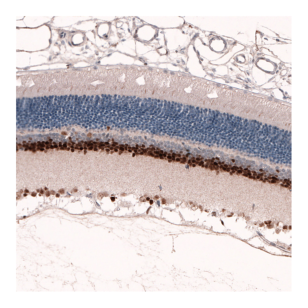 Atlas Antibodies Anti-PAX6 Antibody
