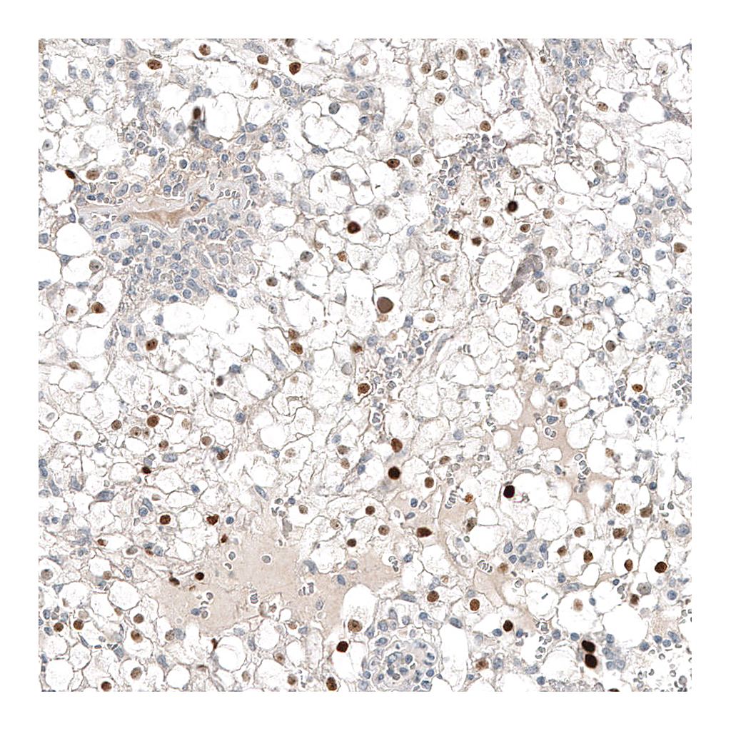 Atlas Antibodies Anti-PAX8 Antibody