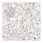 Atlas Antibodies Anti-PAX8 Antibody