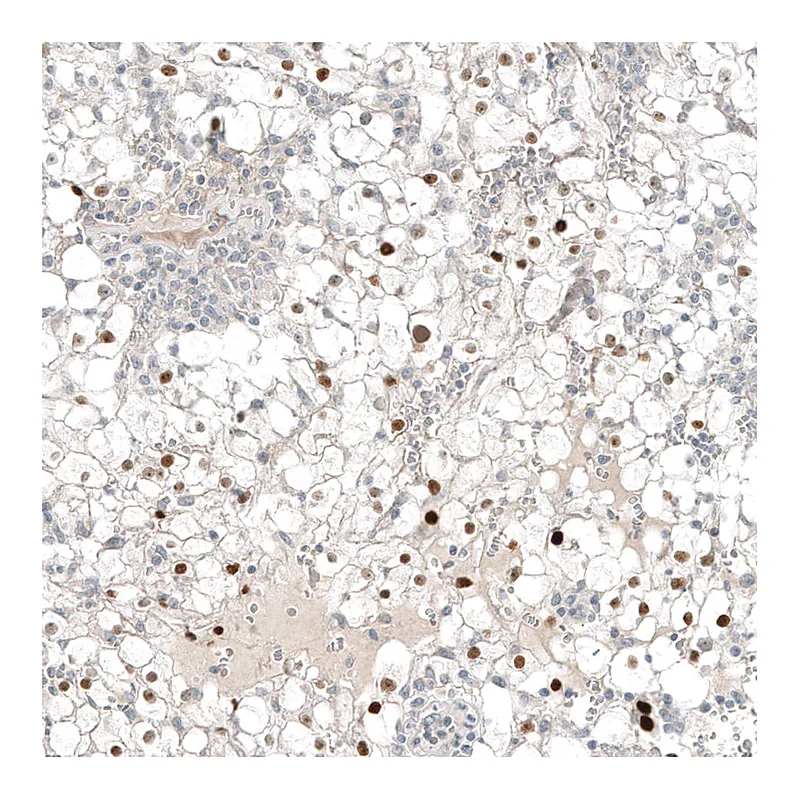 Atlas Antibodies Anti-PAX8 Antibody
