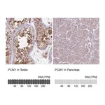 Atlas Antibodies Anti-PCM1 Antibody