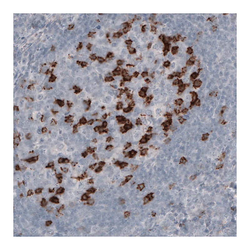 Atlas Antibodies Anti-PDCD1 Antibody