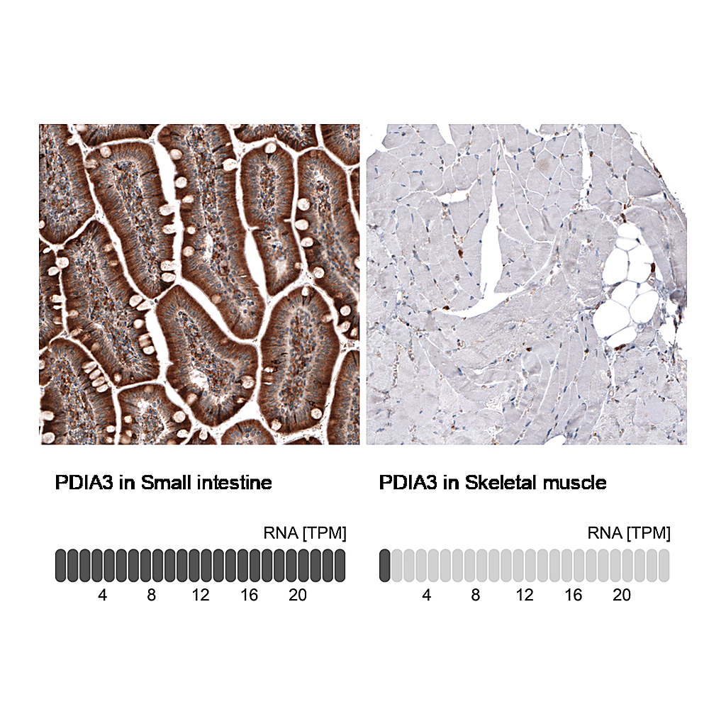 Atlas Antibodies Anti-PDIA3 Antibody