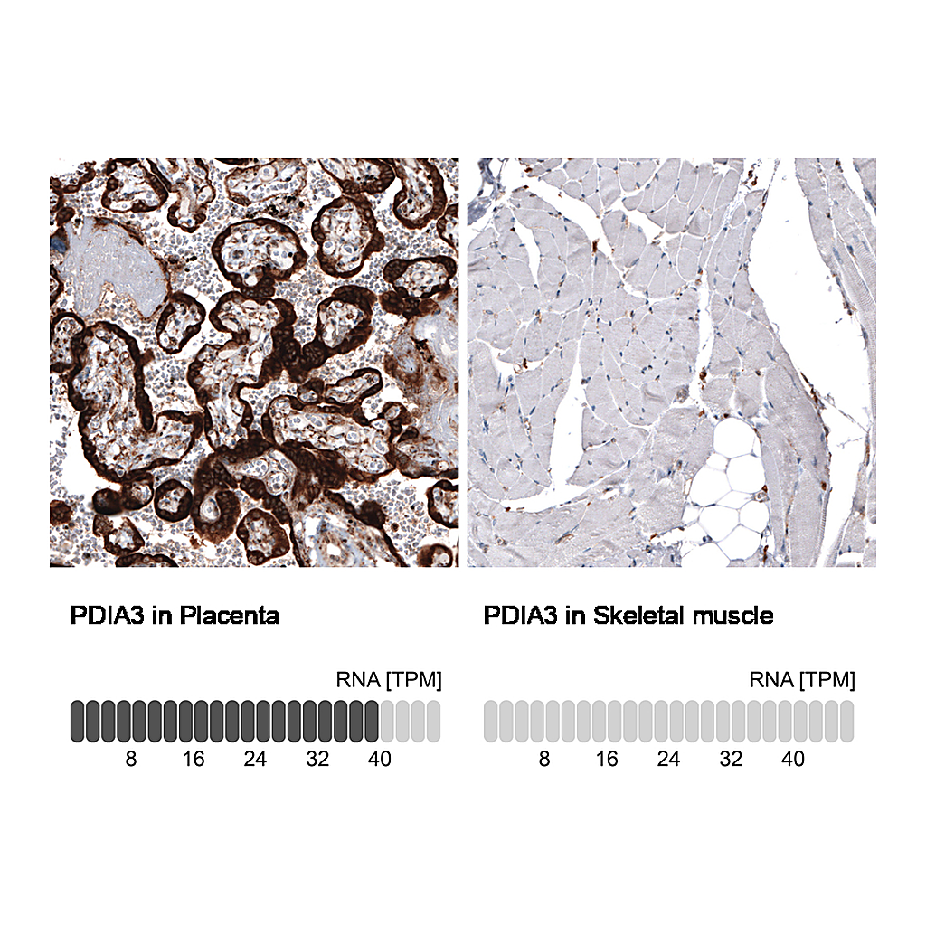 Atlas Antibodies Anti-PDIA3 Antibody