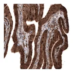 Atlas Antibodies Anti-PFN1 Antibody