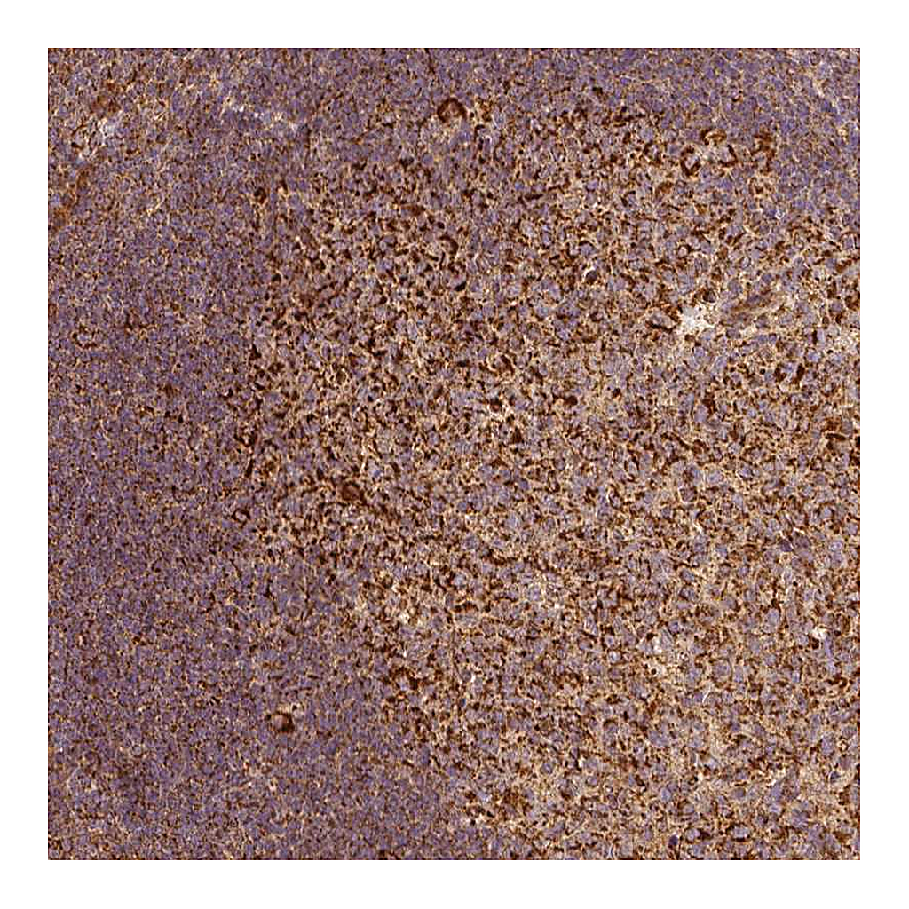 Atlas Antibodies Anti-PGAM5 Antibody