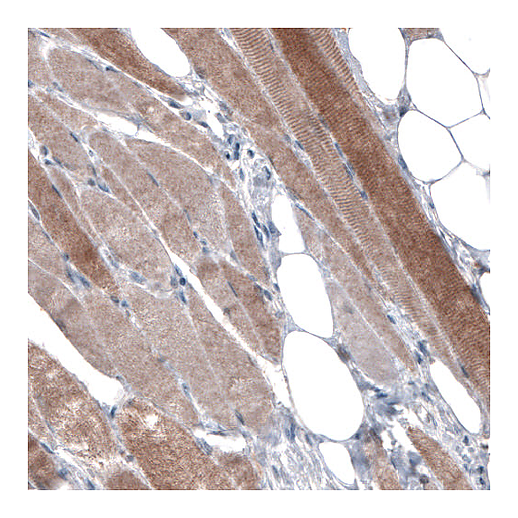 Atlas Antibodies Anti-PGM1 Antibody
