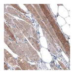 Atlas Antibodies Anti-PGM1 Antibody