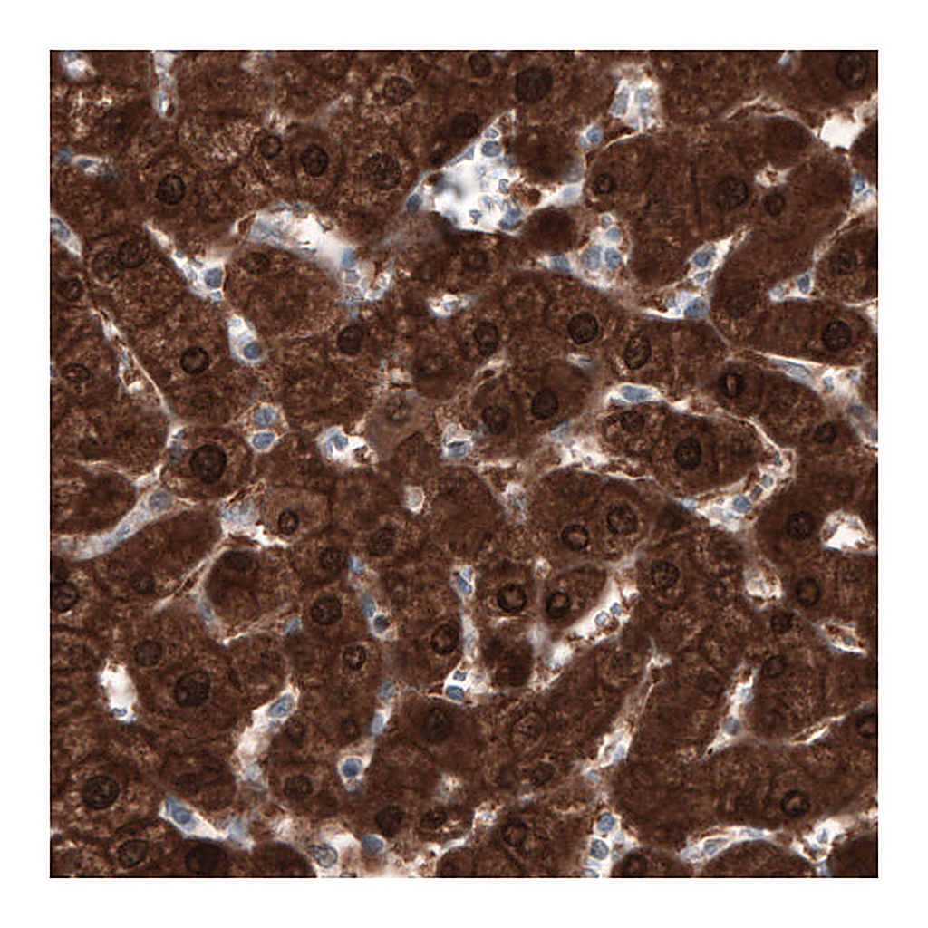 Atlas Antibodies Anti-PGM1 Antibody