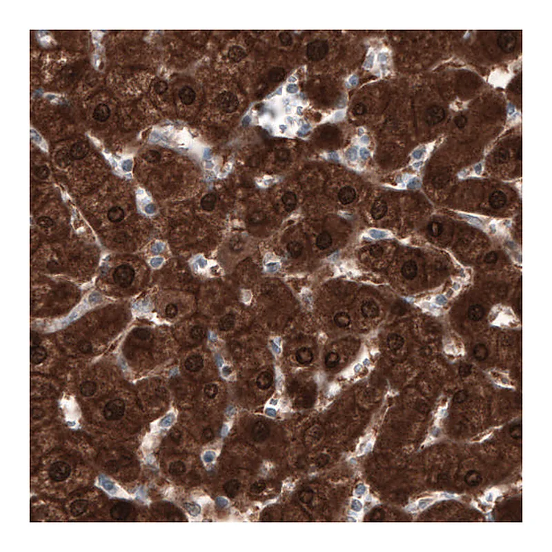 Atlas Antibodies Anti-PGM1 Antibody