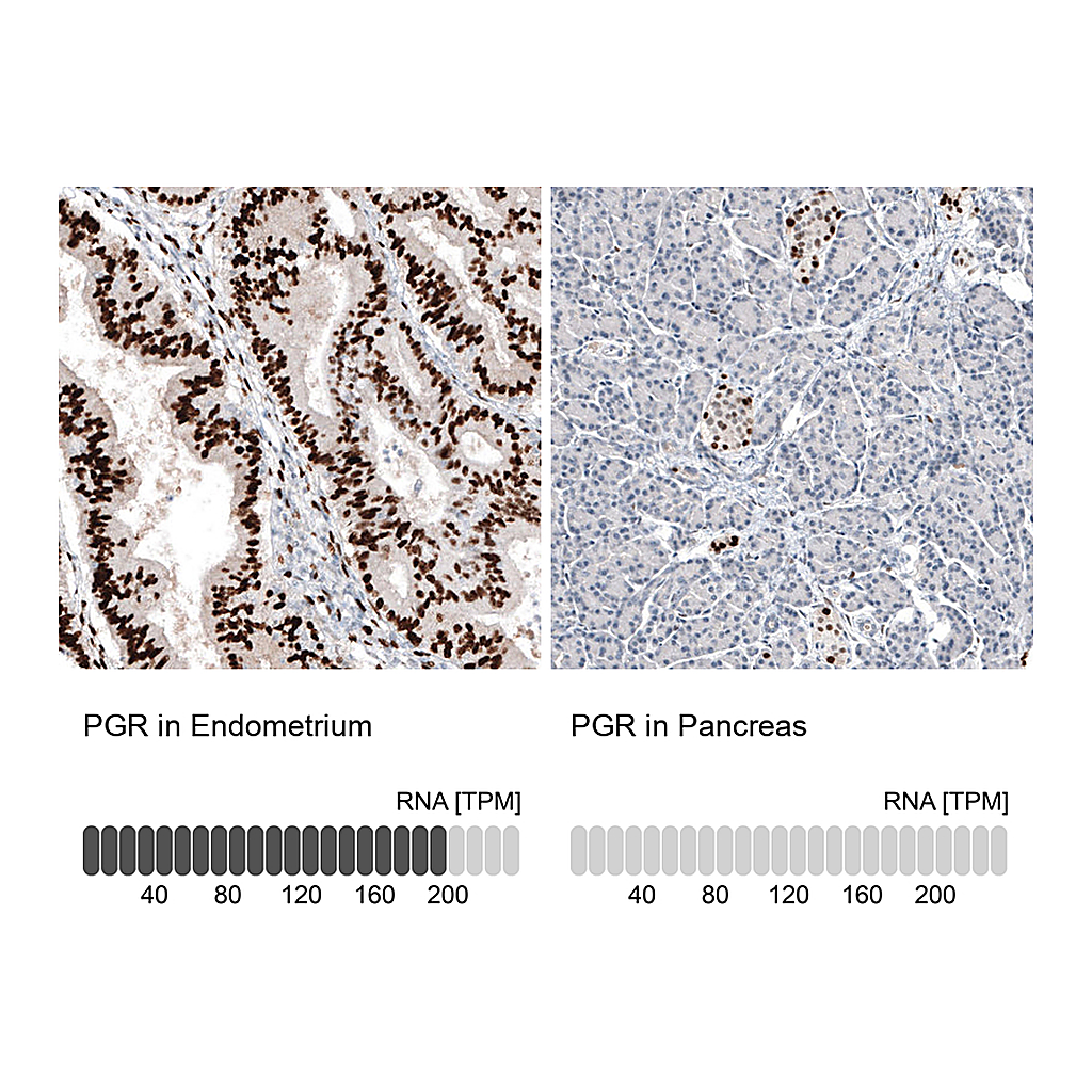 Atlas Antibodies Anti-PGR Antibody